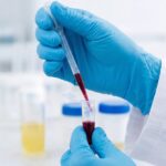 Detrazioni sanitarie nel 730: controlli automatici e meno burocrazia