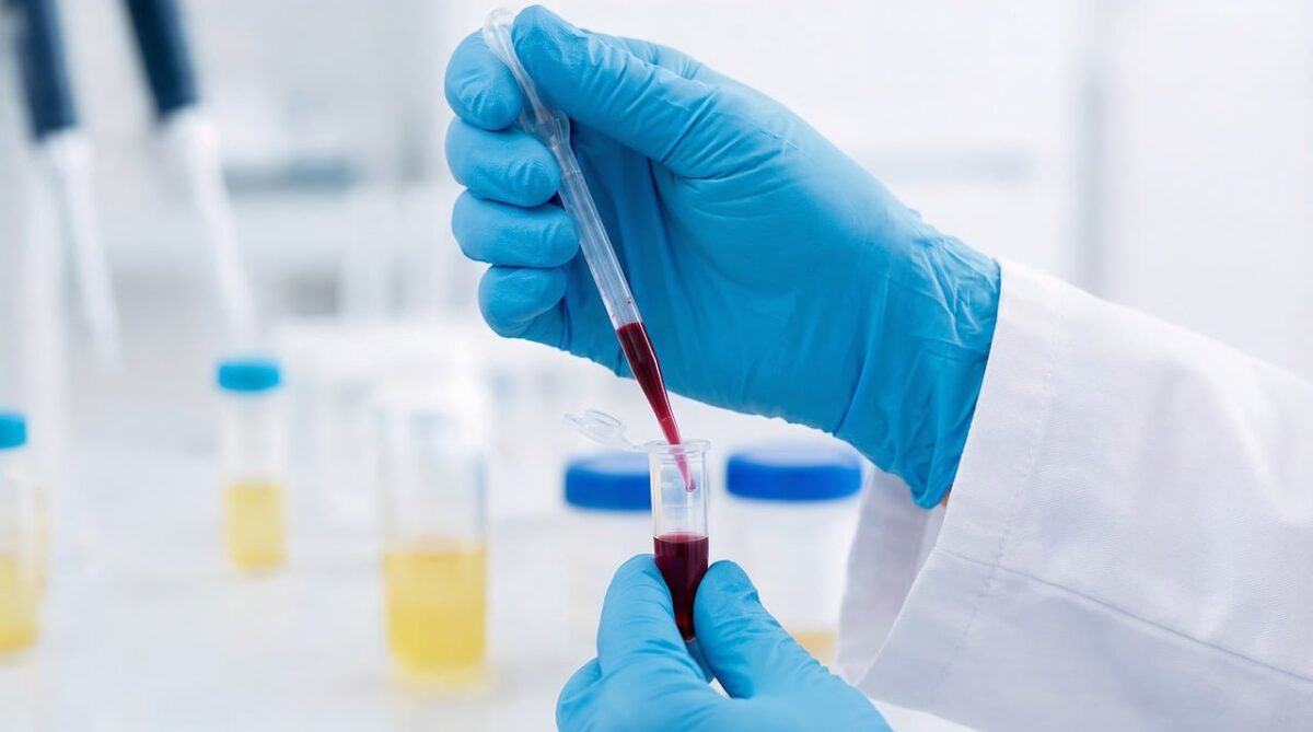 Detrazioni sanitarie nel 730: controlli automatici e meno burocrazia